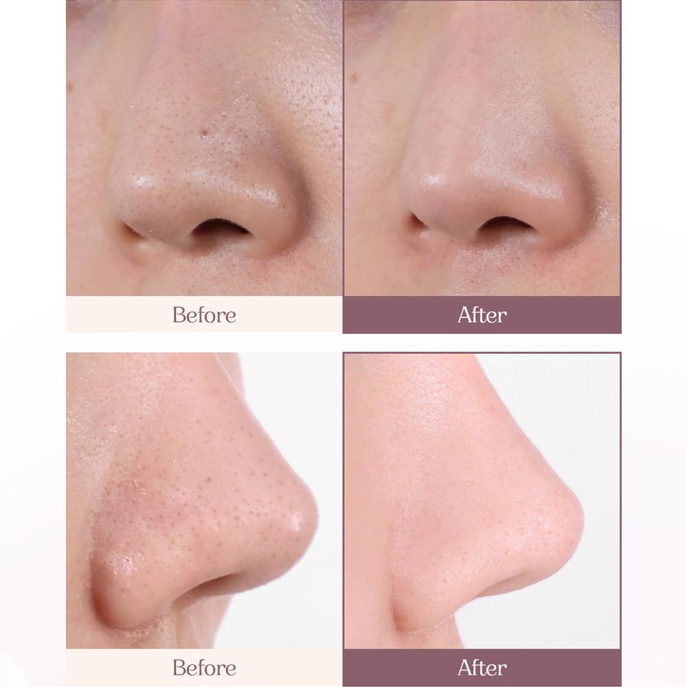 [HEVE BLUE] Pot Pore Tightening Peptamin Podo Sebum Control Nose Pack 7g*4EA