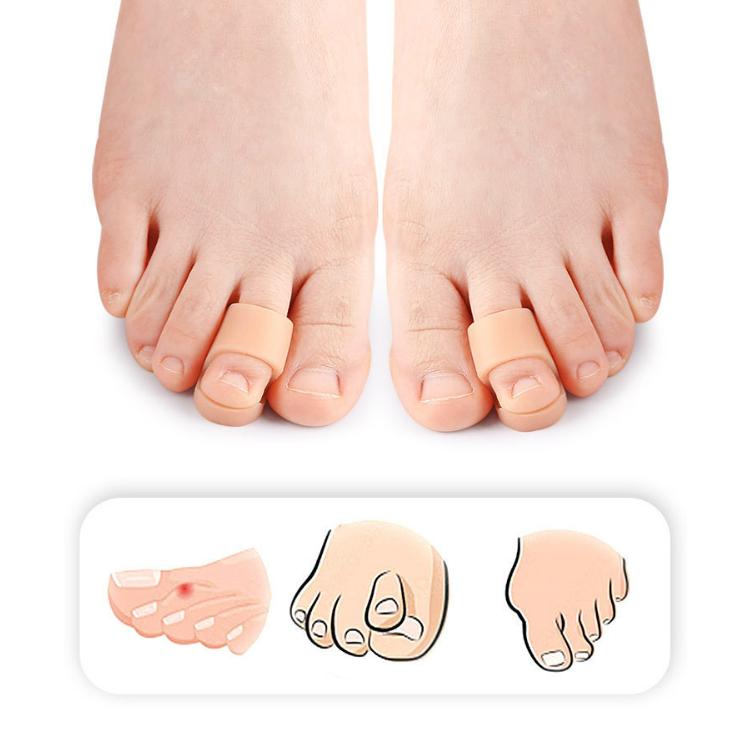 Zehentrenner-Korrektor SEBS Zehenpolster-Glätteisen Fußpflege-Tool Neu