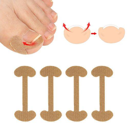 Ingrown toenail protection sticker toenail care toenail care pedicure band