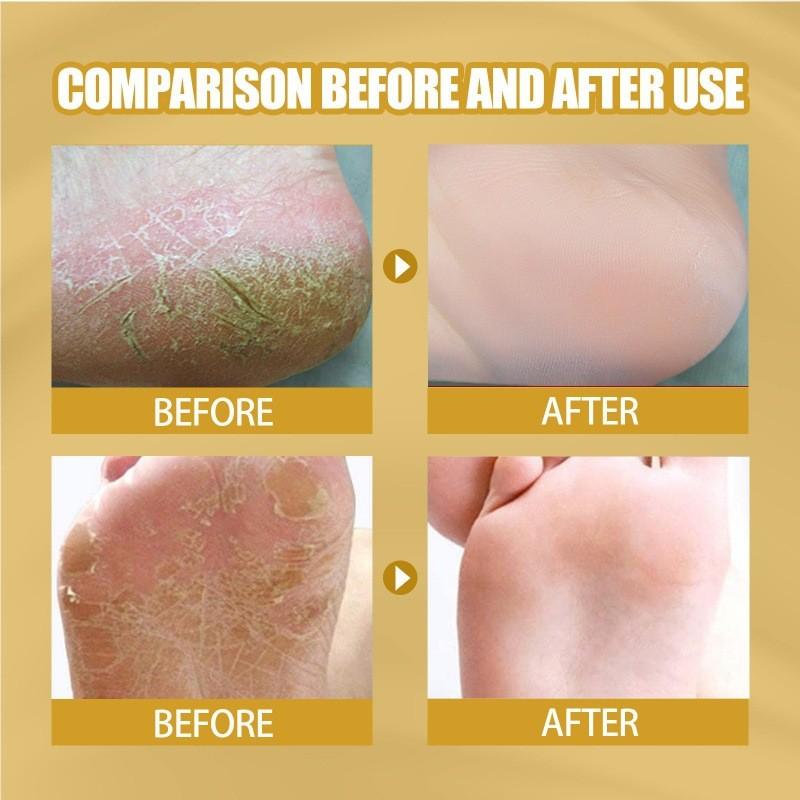 Eelhoe Skin Crack Banana Repair Cream Nourishing Foot Cream For Dry Cracked Skin