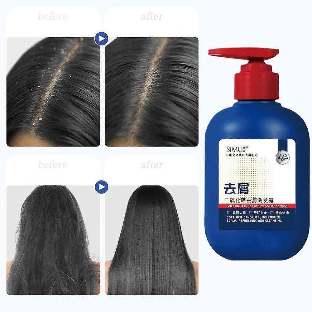 300ml Selenium Disulfide Anti-Dandruff Shampoo Anti-Dandruff Refreshing Oil Control Fluffy Soft Shampoo Shampoo