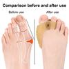 1 Pair Toe Separator for Overlapping Toes Soft SEBS Bunion Corrector Double Hole