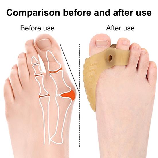 1 Pair Toe Separator for Overlapping Toes Soft SEBS Bunion Corrector Double Hole