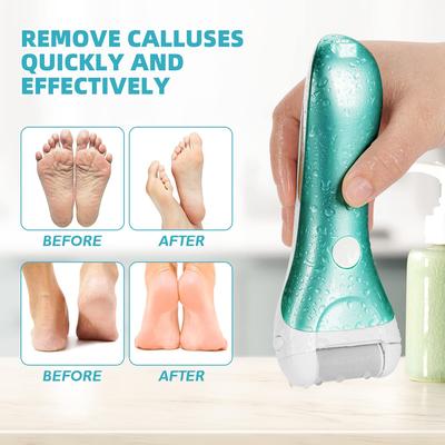 Professionelle Pediküre-Werkzeuge Fuß Hornhautentferner Peeling Hornhautentferner Elektrische Fußfeile für rissige Fersen Fußreiniger Raspeln