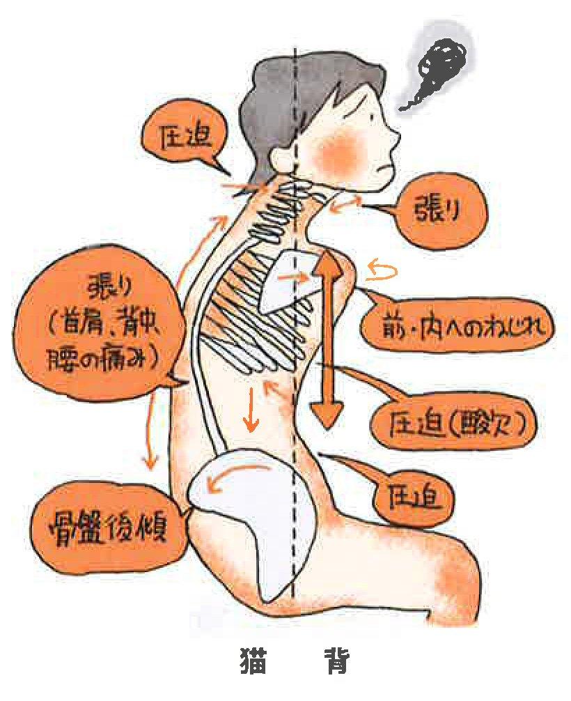 Iliopsoas Relaxation Belt Lakunal Pelvic Posture Core Nursing Care Prevention (M-enji) [Waist Belt, Belt, Correction, Strengthening, Exercise]