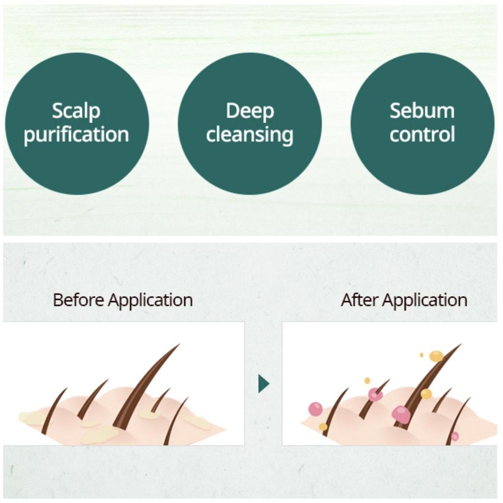 Ryo Chung Ah Scalp Deep Cleansing Shampoo 550ml (Sebum Control Care/Dandruff Care/For Oily Scalp)