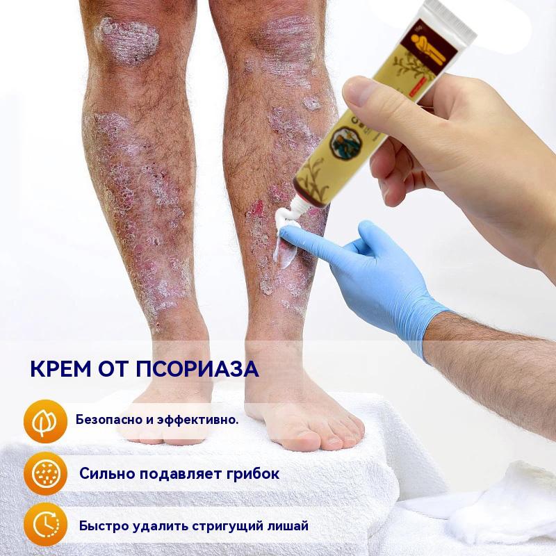 Caoshifu Natural Herbs Creams for Itch Solve Skin Problems 15g