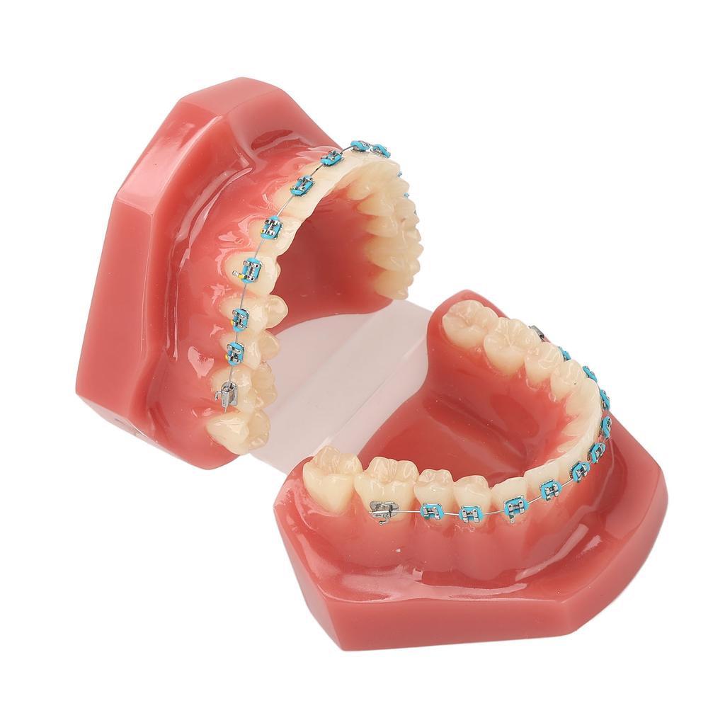 Dental Orthodontic Model 28pcs Teeth Resin Dental Teaching Teeth Model with Metal Braces