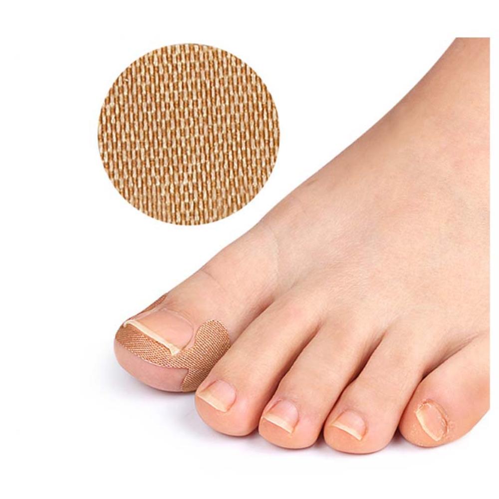 Zehennagelkorrektur für Pflege Zehennagelbehandlung Aufkleber Korrektur Erholungspflaster Fußeinlagen