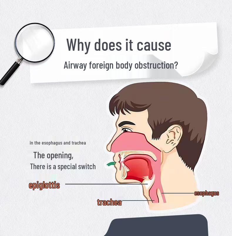 Dispositivo Antiasfissia Completamente Automatico Heimlich: Aspiratore Faringeo Portatile per il Soccorso da Soffocamento nei Bambini