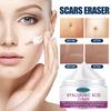 Scar Repair Cream Fade Post-scald Scar Moisturizing Repair Remove Cellulite Scar Cream
