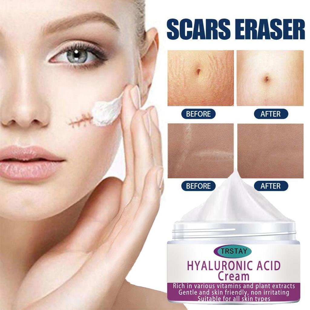 Scar Repair Cream Fade Post-scald Scar Moisturizing Repair Remove Cellulite Scar Cream