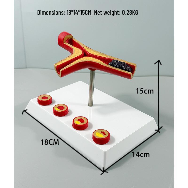 Dynamic Blood Vessel Model: Human Body Flow Simulation and Plaque Comparison Display