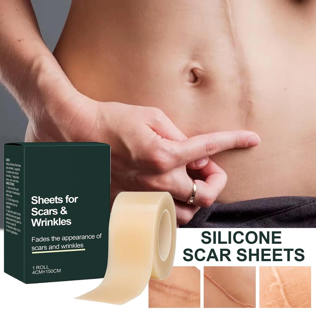 Silicone Scar Patch Skin Repair Sheets Removal Self-Adhesive Stretch Mark Tape Therapy Patch For C-Section Burn Acne Scar