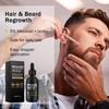 5% Minoxidil Haarwachstums-Serum mit Biotin, 60ml Haarwiederherstellungs-Behandlung gegen Haarausfall und Ausdünnung