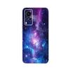 Transparent Tpu Coque Cover For Vivo X60 Pro Case High Quality Luxury Silicone Soft Phone Case For Vivo X60 4G 5G X60T X 60 Case
