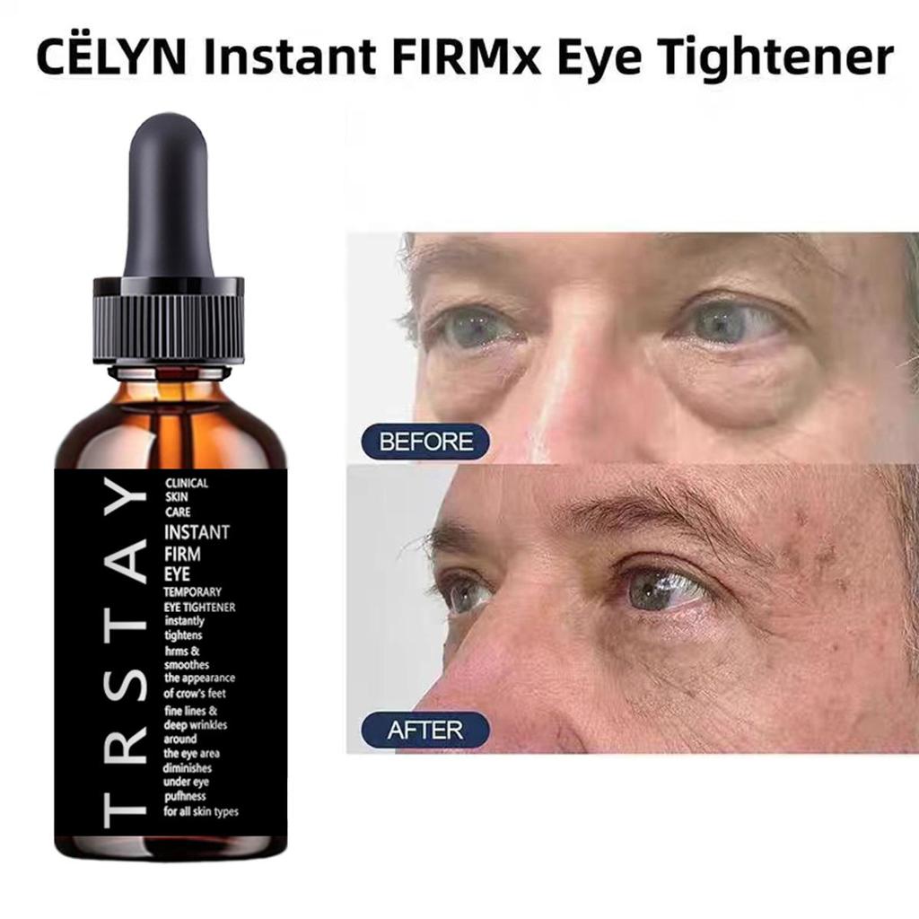 Temporary Eye Bags Removal Cream Instant Under Eye Firming And Tightening Eye Cream Lifts And Firms Eye Skin For Dark Circles