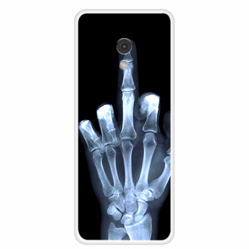 

For Nokia 235 4G 2024 Case Soft Back Cover for Nokia 215 220 4G 2024 Clear Silicone Phone Cases for Nokia 220 Transparent Fundas Nokia235 4G 2024