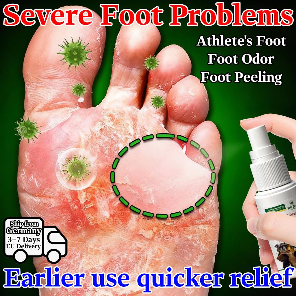 Organic Lotion for Chilblains & Dry Cracked Hands Feet - Gentle Skin-Caring