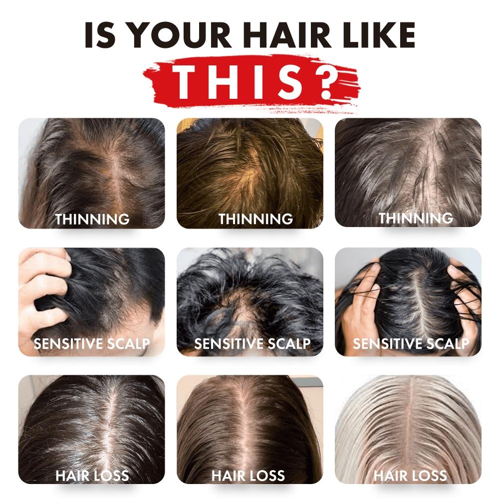 Alfheim Coffee+ Thickening Shampoo 33.8 Oz  Caffeine Biotin Volumizing Shampoo