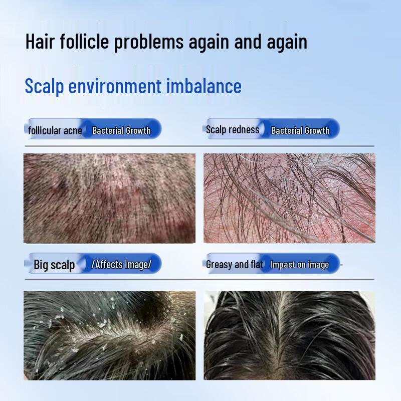 

LEASCAN Selenium Disulfide Anti-Dandruff Shampoo