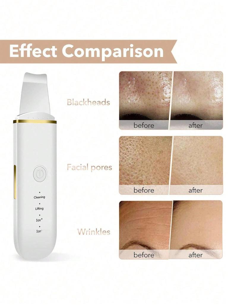 Facial Scraper, Pore Cleaner, Blackhead Removal Tool, Used for Deep Facial Cleansing and Skincare, Preferred As a Gift.