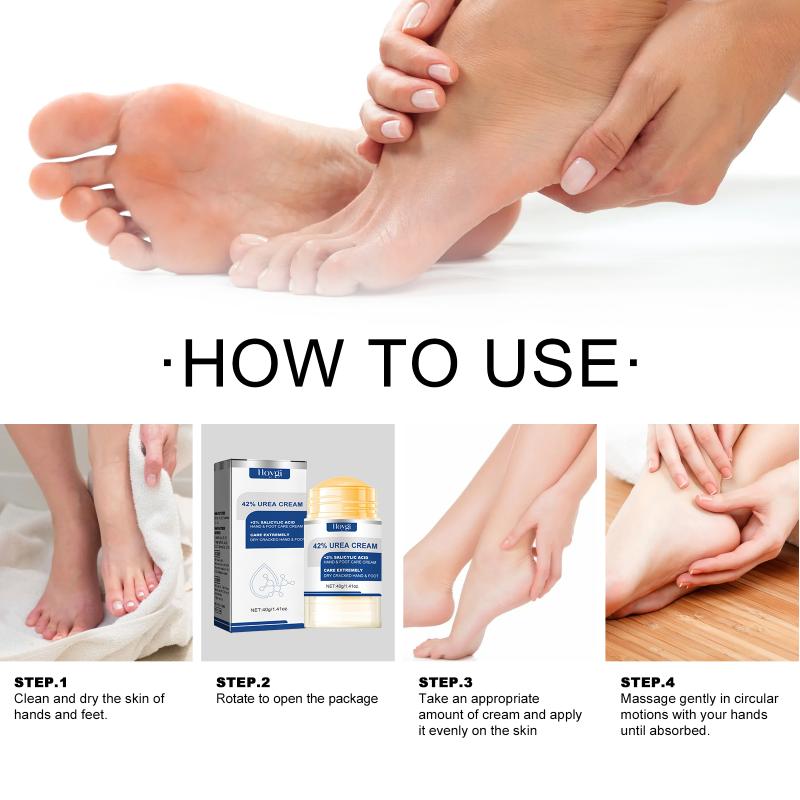 42% Urea Foot Cream Aloe Vera Ultra-Hydrating Softening Dry Cracked Feet Cream Gentle Exfoliation Daily Foot Care Solution one size
