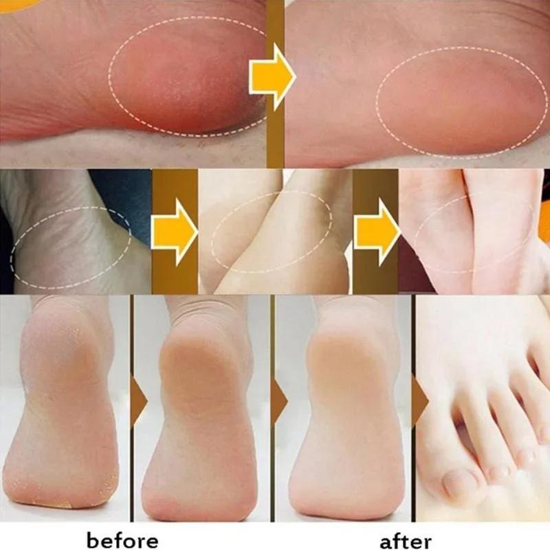 Snake Oil Moisturizing Cream for Dry Skin Relief Deep Hydration Body Balm for Cracked Skin Care 30g
