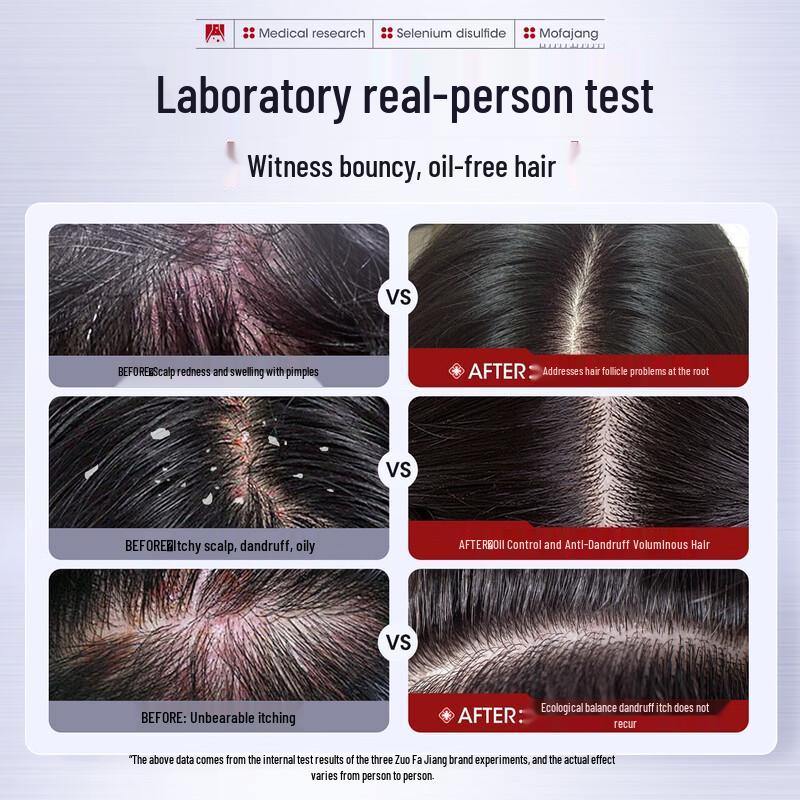 Three Magicians Selenium Sulfide Anti-Dandruff Shampoo