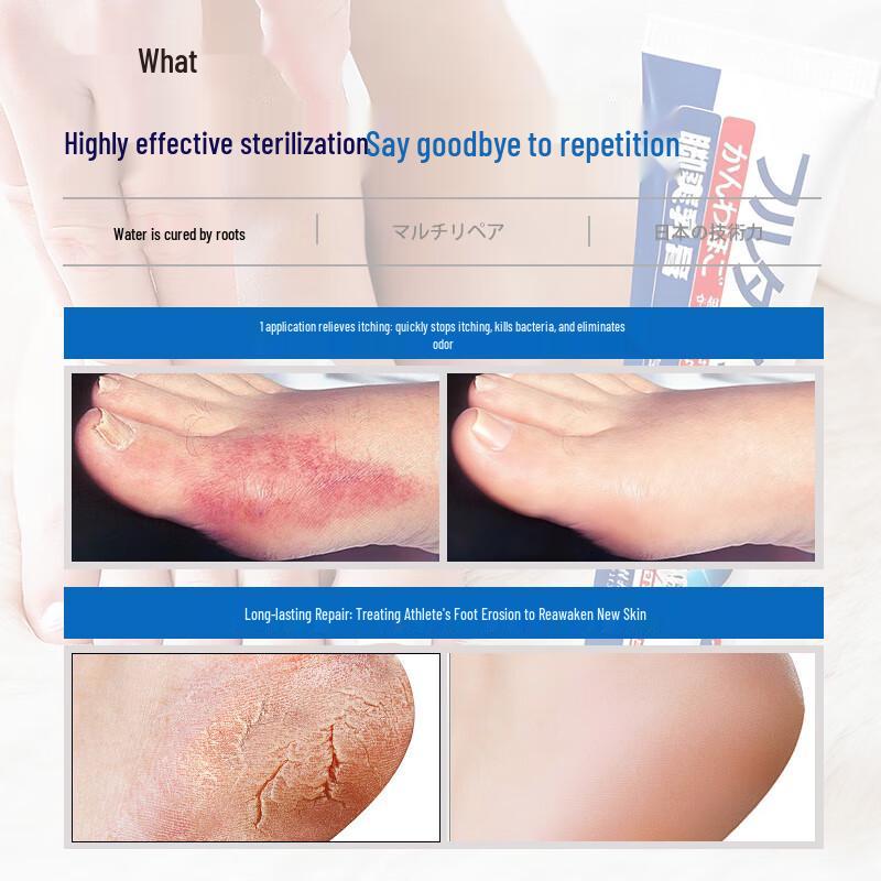 Miyamoto Tanaka Athlete's Foot & Foot Odor Treatment