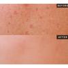 [HEVE BLUE] Single Vita Dark Spot Pine-Ampoule 50ml