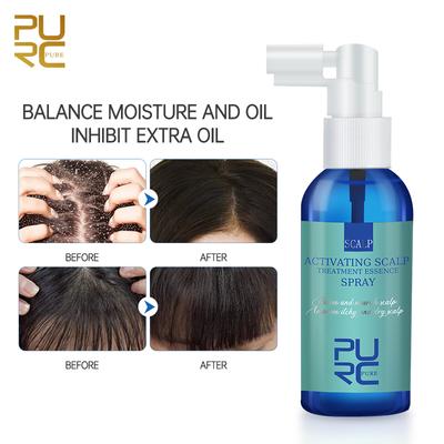 Saç Derisi Bakım Özü Sprey Kepek Önleyici Kaşıntı Önleyici Peeling Yağ Kontrolü Saç Dökülmesi Karşıtı 60ml