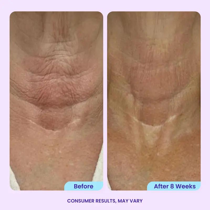 GOPURE Neck Cream Tighten & Lift Firming Cream for Crepey Skin