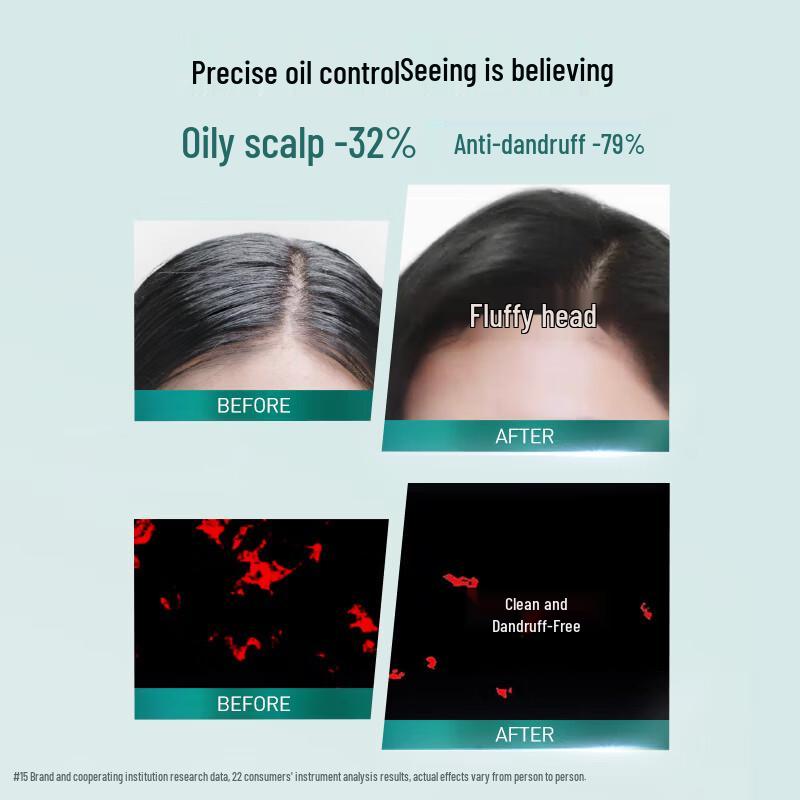 L'Oréal Scalp Oil Control Purifying Shampoo 440ml