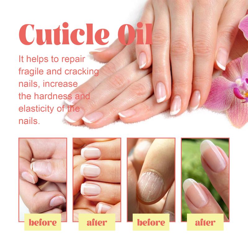 Nail Care Oil 30ml Hydrating Cuticle Softens Promotes Healthy Nail Growth Beauty Routine