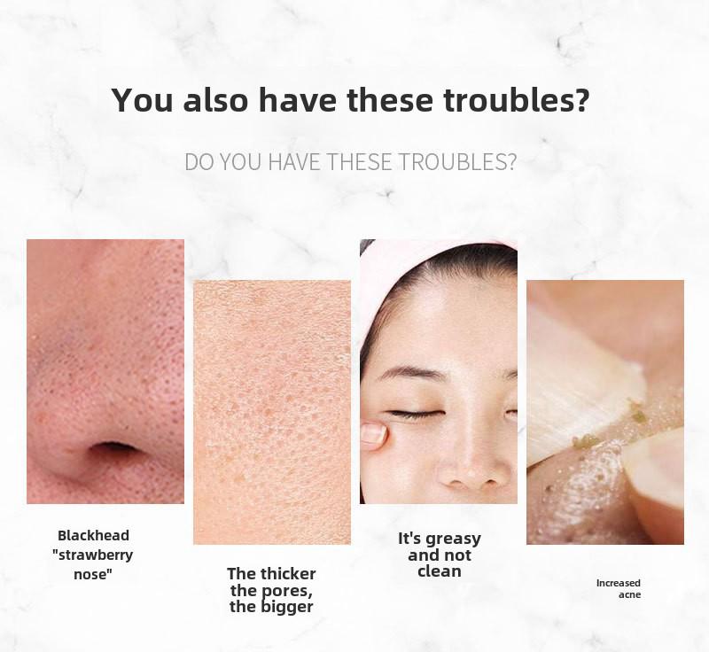 Ultrasonic Skin Scrubber & Blackhead Remover - Pore Cleanser & Acne Device.