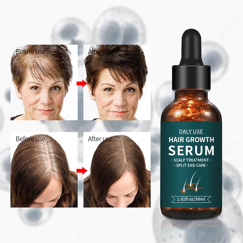 Ginger Polygonatum Anti-hair Loss Serum Fluid,Long Hair Dense Development Hair Growth Essence
