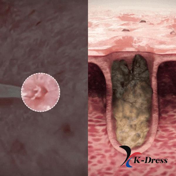 Medicube Zero Pore Pad 2.0