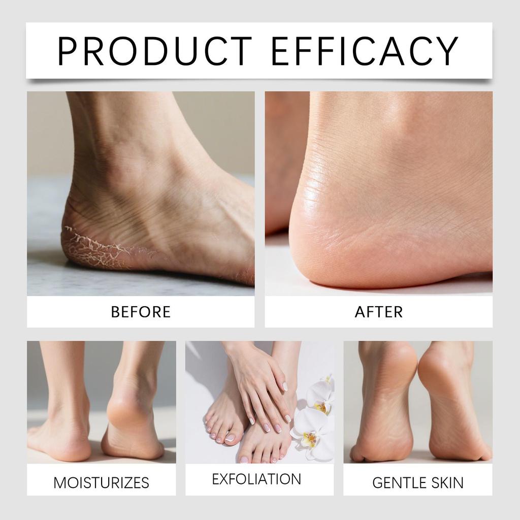 OceAura Aloe Moisturizing and Nourishing Foot Mask Daily Care for Dry and Rough Feet Moisturizing and Softening Foot Care Mask 5pcs