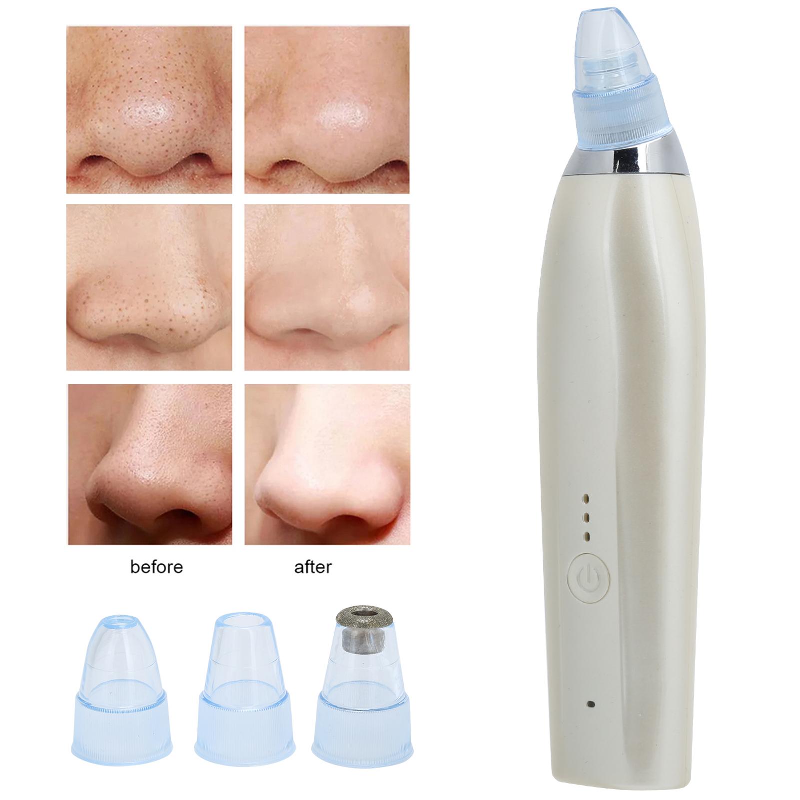 

Rechargble Electric Blackhd Removal NaMachine Vacuum Suction Face Pore Clner