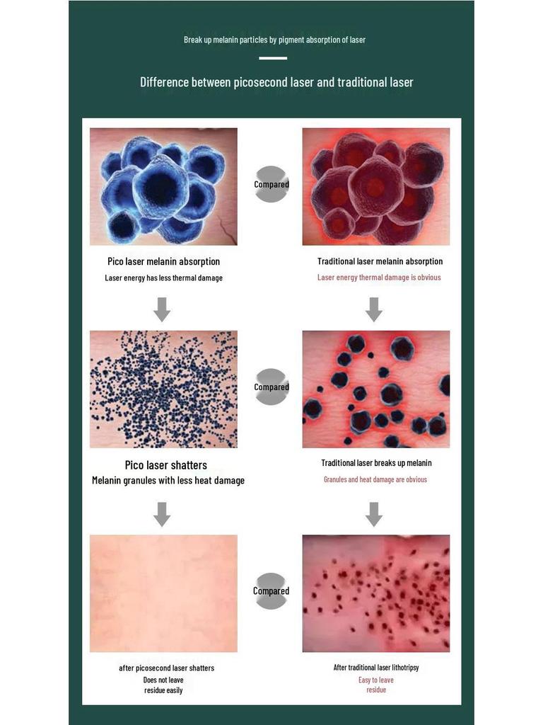 Picosecond Laser Pen for Eyebrow Tattoo & Freckle Removal