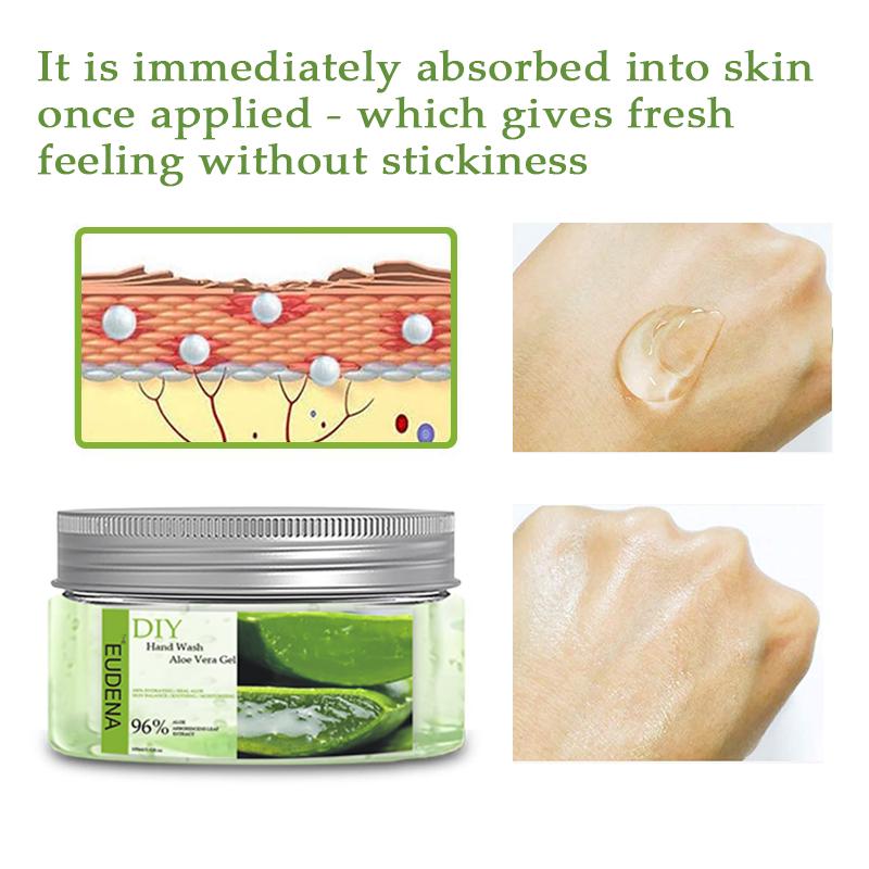diy acne cream