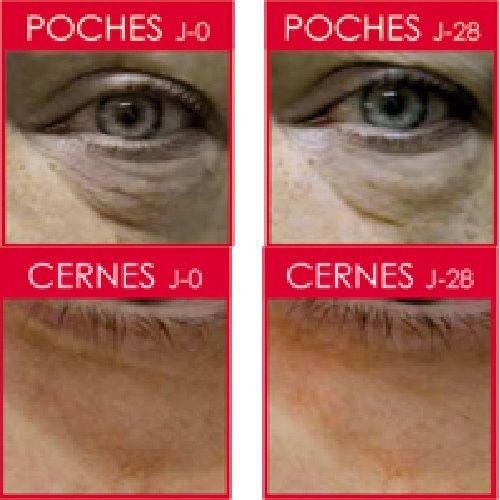 Lumin'Eye Korekční péče na váčky a tmavé kruhy pod očima