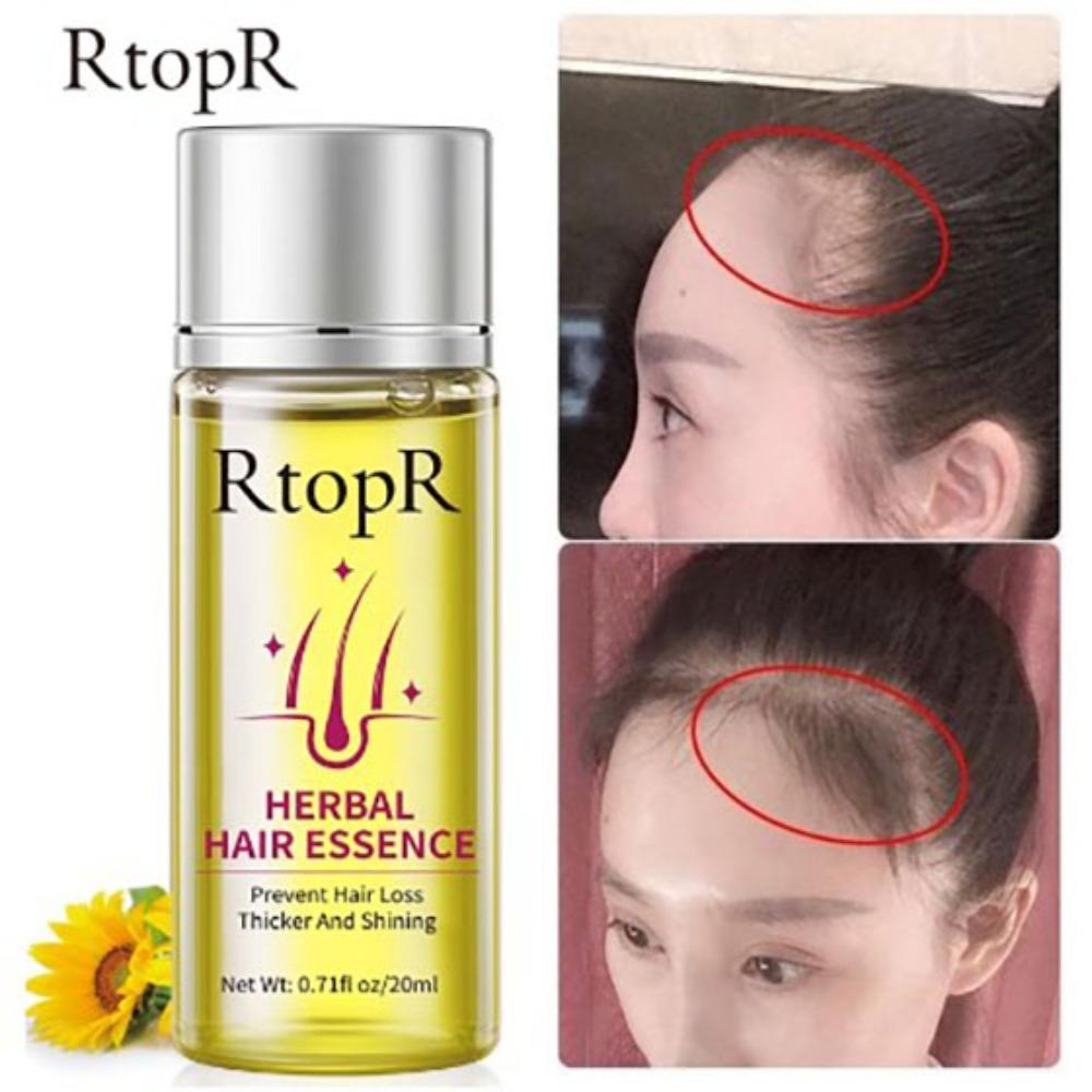 

Восстанавливающее масло для волос головы Питающее восстанавливающее жидкость для волос Прочное травяное масло для волос RtopR