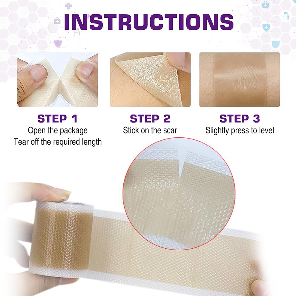 1 Roll Easy-Tear Silicone Gel Tape Roll - Medical Grade Wound Dressing, Sticky Bandage, Latex-Free, Adhesive, Soft Flexible