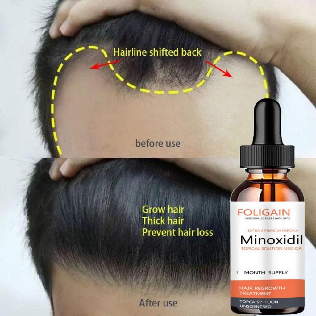 Liquide de soin hydratant pour la croissance des cheveux Favorise la croissance des cheveux, prévient la chute des cheveux, épaissit les cheveux Huile essentielle de soin