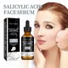 Salicylic Face Serum, Face Serum with Salicylic Acid, Anti-imperfection Serum Contrasts Black Spots and Bruises, Face Serum Reduces Thin Lines