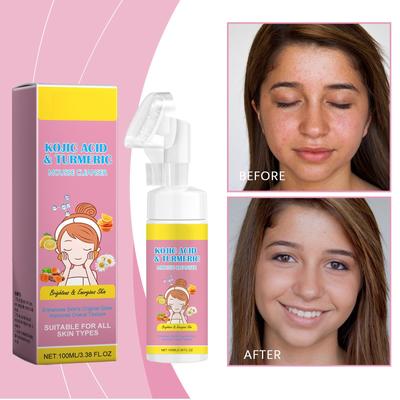 100ml Kojic-happe Ingveri Mousse Näopuhastusvahend, Niisutav, Lukustav Vee Temperatuuri Ja Puhastav Nahka Vaht Näopuhastusvahend