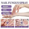 Medinail Fungus Spray,Toenail Fungus Treatment,Nail Fungus Treatment For Toenail