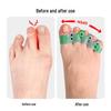 Colorful SEBS Five-Hole Toe Separator for Bunions and Overlapping Toes